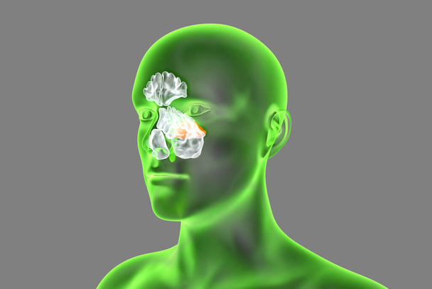 Anatomie van paranasale sinussen. 3D illustratie tonen menselijk lichaam met gemarkeerde sfenoïde sinussen - Foto, afbeelding