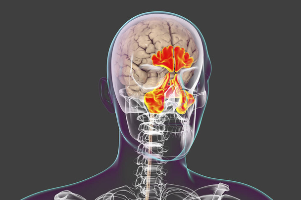 Anatomy of paranasal sinuses. 3D illustration showing male body with skeleton, brain and highlighted paranasal sinuses - Photo, Image