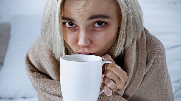 donna malata guardando la fotocamera mentre beve bevanda calda in camera da letto - Foto, immagini
