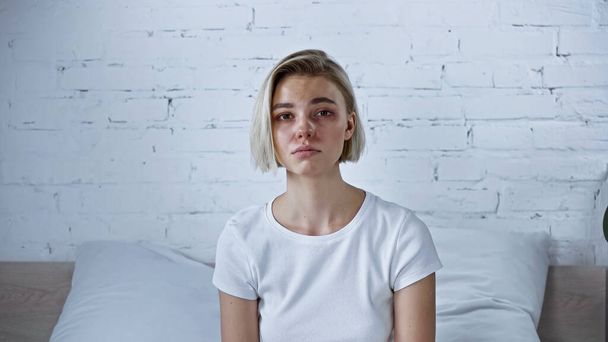 Unzufriedene kranke Frau blickt im Schlafzimmer in Kamera - Foto, Bild