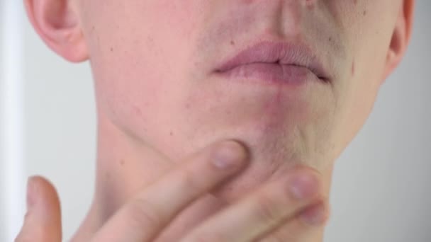 Een jonge man streelt de huid van zijn gezicht na het scheren close-up in de badkamer.Gezichtsverzorging, scheren gezichtshaar, stoppels, snor en baard.Een geschoren man.Huidproblemen, huiduitslag, mee-eters, puistjes - Video