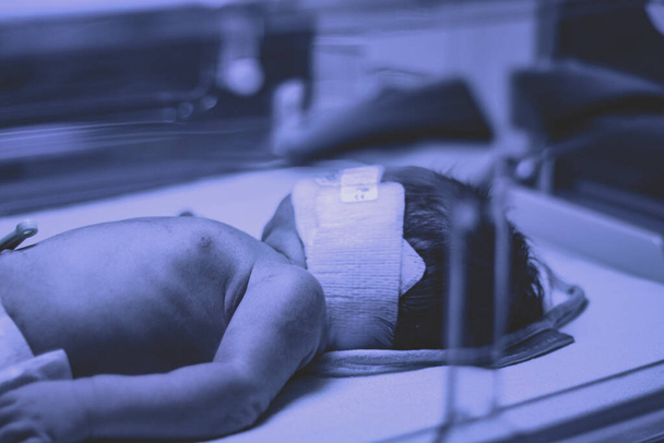 Recién nacido bajo lámpara ultravioleta está recibiendo tratamiento para la ictericia (bilirrubina elevada) en el hospital de Vancouver - Foto, Imagen
