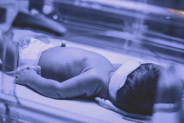 Pasgeboren baby onder ultraviolette lamp wordt behandeld voor geelzucht (verhoogde bilirubine) in Vancouver ziekenhuis - Foto, afbeelding