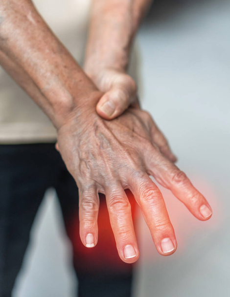 Περιφερική νευροπάθεια πόνος σε ηλικιωμένους ασθενείς στο χέρι, παλάμη, δάχτυλα και αισθητήρια νεύρα με μούδιασμα, πόνο, μυϊκή αδυναμία, μαχαίρωμα, κάψιμο από χρόνια φλεγμονώδη απομυελινωτική πολυνευροπάθεια - Φωτογραφία, εικόνα