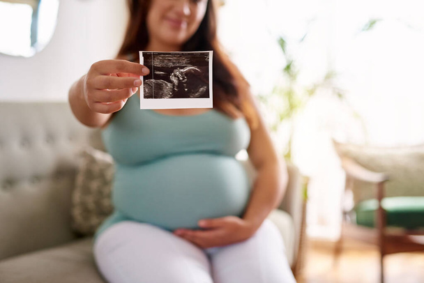 Mosolygó fiatal terhes nő kezében egy ultrahang kép a meg nem született baba, miközben pihen a kanapén otthon - Fotó, kép