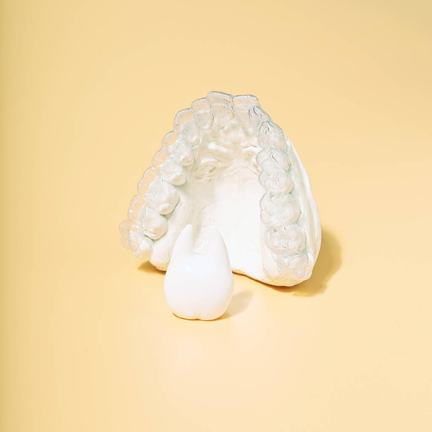 Tema dental de ortodoncia sobre fondo amarillo.Alineadores dentales invisibles transparentes o frenos aplicables para un tratamiento dental de ortodoncia - Foto, Imagen