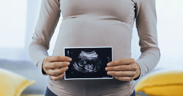 Ausgeschnittene Ansicht einer schwangeren Frau zeigt Ultraschalluntersuchung des Babys  - Foto, Bild