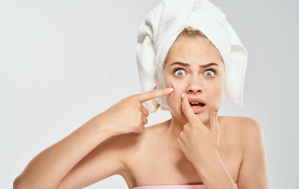 Mujer molesta exprime espinillas en su cara y una toalla en su cabeza fondo gris cosmetología dermatología - Foto, imagen
