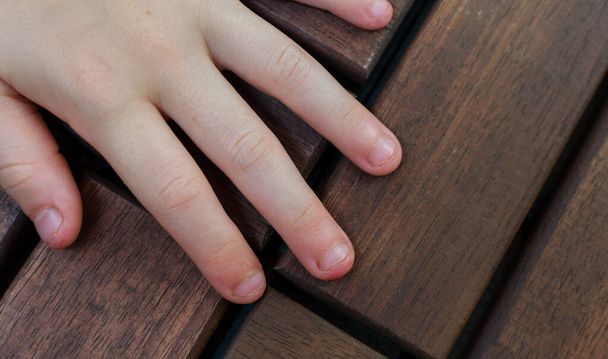 Kousané nehty - ukousnuté prsty. Zblízka ruku s pokousanými dětskými nehty - Fotografie, Obrázek