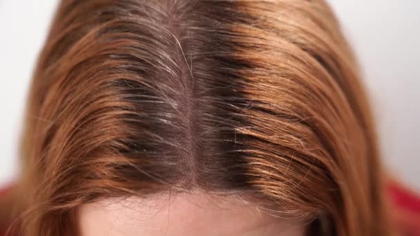 grown after staining the gray roots of hair on the head of a woman.  - Footage, Video