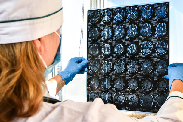 Docteur dans la protection des gants tenant l'IRM cérébrale dans un cabinet médical. IRM de la tête humaine à la clinique. Médecin du cerveau professionnel donner un conseiller au patient - Photo, image