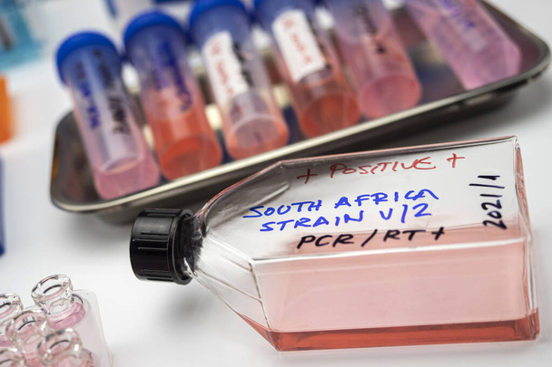 Güney Afrika 'daki yeni varyantın covid-19 enfeksiyonu pozitif çıktı.. - Fotoğraf, Görsel