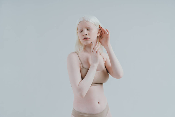 Beauty image of an albino girl posing in studio wearing lingerie. Concept about body positivity, diversity, and fashion - Fotoğraf, Görsel