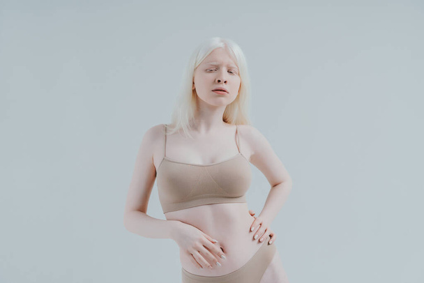 Beauty image of an albino girl posing in studio wearing lingerie. Concept about body positivity, diversity, and fashion - Фото, изображение