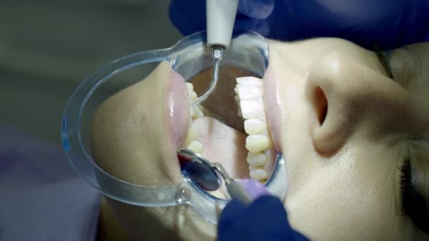 teeth alignment in the clinic - Footage, Video