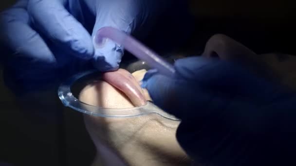 tandheelkundige behandeling in de kliniek - Video