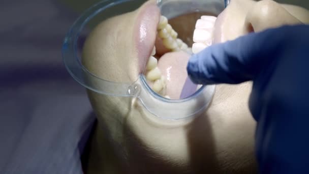 fogorvos által végzett fogászati vizsgálat - Felvétel, videó