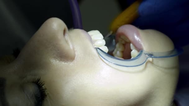 Zubní prohlídka u zubaře - Záběry, video