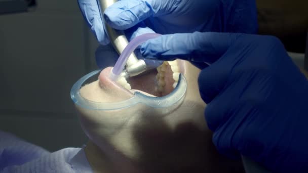 pulido de dientes en el dentista - Imágenes, Vídeo
