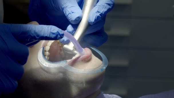 tandenpoetsen bij de tandarts - Video