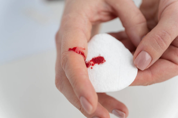 close up image of bleeding finger of young female, cotton pad collecting blood. Accident due to careless usage of sharp instruments. - Photo, Image