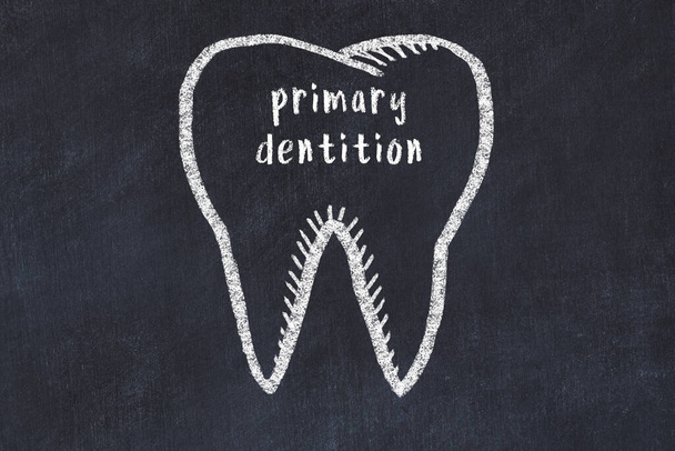Gesso disegno di un dente con termine medico dentizione primaria. Concetto di stomatologia dell'apprendimento. - Foto, immagini