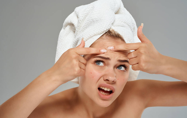 Emotional woman with a towel on her head squeezes out pimples on her face on a gray background - Photo, Image