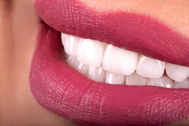 Идеальный крупным планом чувственный сексуальный соблазнительный пухлые губы женщина улыбка. Белые красивые зубы отбеливания керамические короны отбеливания юная леди улыбается. Реставрация зубных цирконовых имплантатов - Фото, изображение