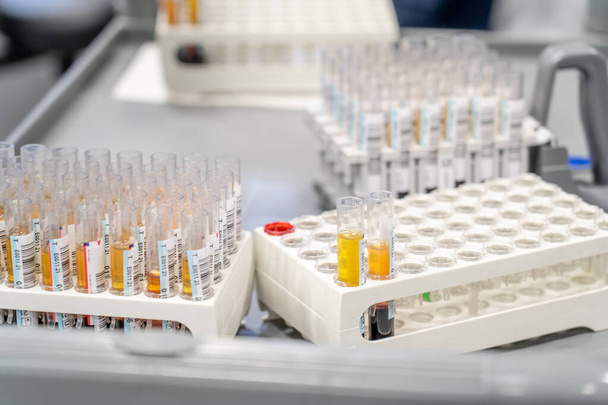 laboratorium doet tests voor het verzamelen van vaccins en hematologische analyses - Foto, afbeelding