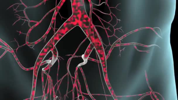 Záběry pulzního abdominálního aortálního aneurysma - Záběry, video