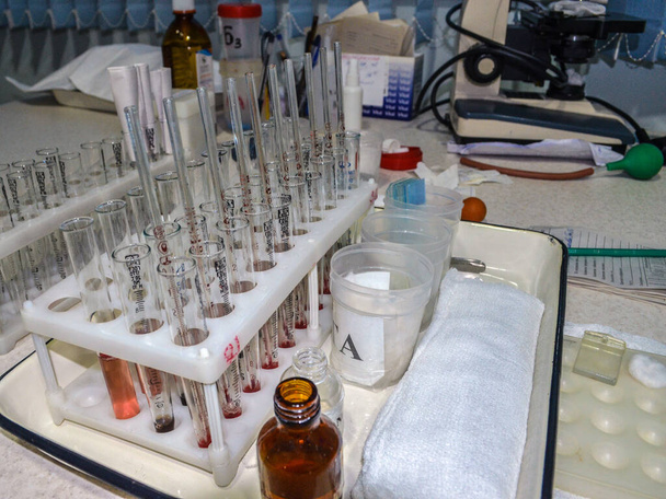Medizinische Reagenzgläser für Blut- und Urinanalysen im Hintergrund des Mikroskops verschwimmen besonders. - Foto, Bild
