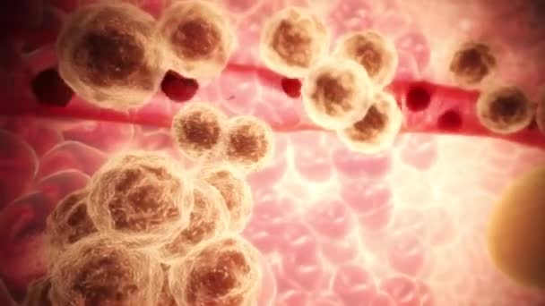 Komórki nowotworowe powodujące przerzuty nowotwór nowotworowy - 3D animacja renderowania - Materiał filmowy, wideo