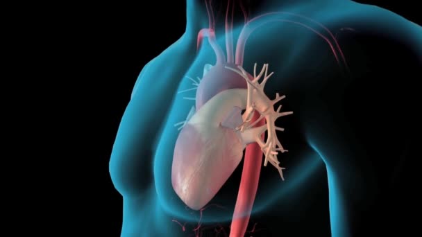 CTA Intera aorta immagine di rendering 3D invertire sullo schermo per rilevare aneurisma aortico. - Filmati, video