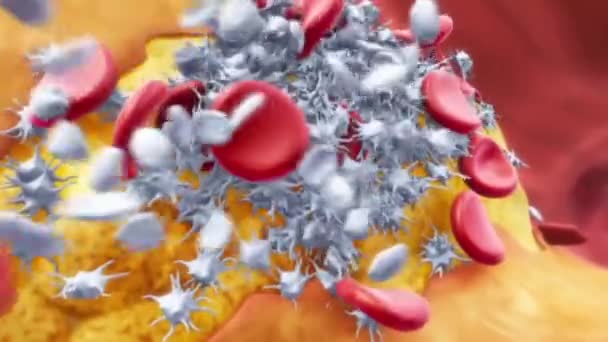 Depiction of a blood clot forming inside a blood vessel. 3D animation - 映像、動画