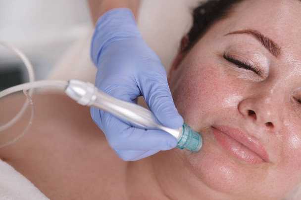 Top view close up of plus size woman enjoying vacuum pores cleanse at beauty salon - Photo, Image