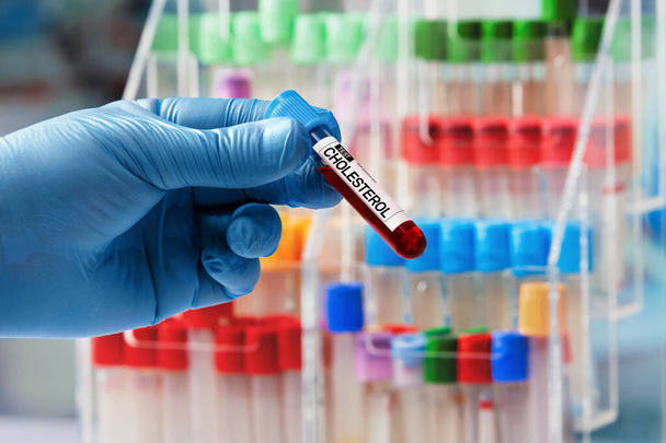 Ręka lekarza pobierająca próbkę krwi z półki w laboratorium / Technik trzymający rurkę z etykietą Cholesterol w laboratorium banku krwi - Zdjęcie, obraz