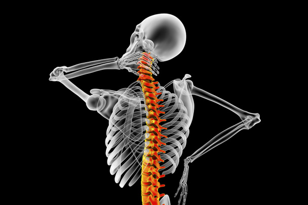Πόνος στον λαιμό, τρισδιάστατη εννοιολογική απεικόνιση - Φωτογραφία, εικόνα