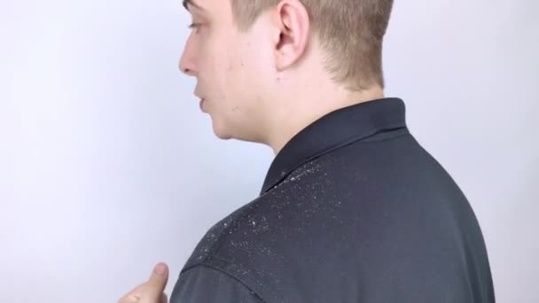 Πιτυρίδα στον ώμο ενός άντρα. Πλευρική άποψη ενός άντρα που έχει περισσότερες νιφάδες πιτυρίδας στο μαύρο του πουκάμισο. Σκάλπ θεραπεία ασθένεια έννοια. Δυσφορία από μυκητιασική λοίμωξη - Πλάνα, βίντεο