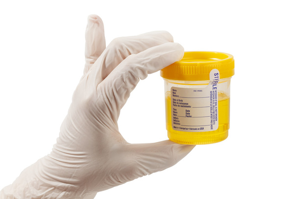 urine monster met handschoen - Foto, afbeelding
