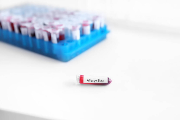 Allergietest im Labor auf dem Tisch - Foto, Bild