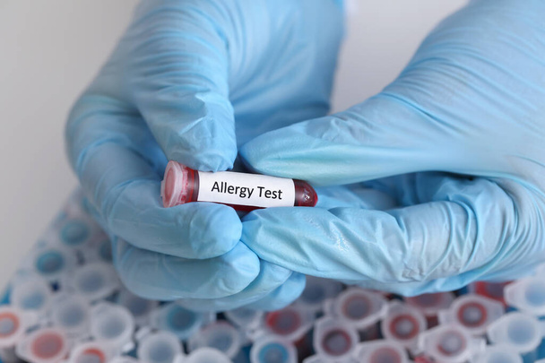 Médico con prueba de alergia en laboratorio - Foto, imagen