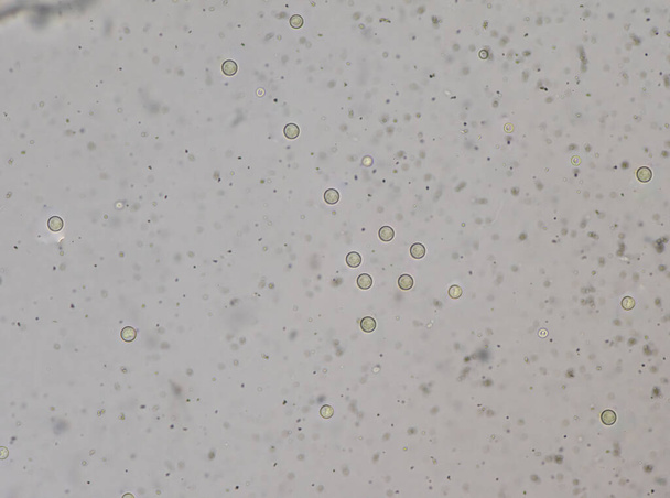 Cryptococcus neoformans is an encapsulated fungal organism and it can cause disease in apparently immunocompetent, as well as immunocompromised, hosts. - Photo, Image