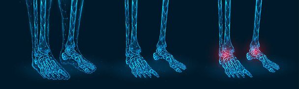 Ayak bileğinde ağrı, yaralanma veya iltihap çokgen vektör çizimi. İnsan ayağının düşük polimerli modeli. - Vektör, Görsel
