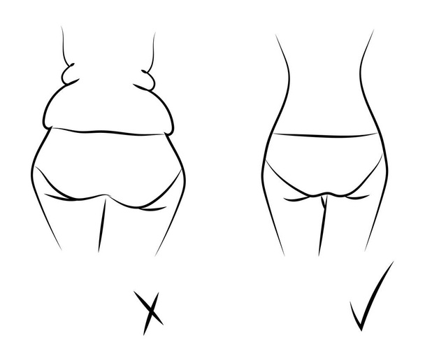 A női test fogyás előtt és után. Vektorillusztráció. - Vektor, kép