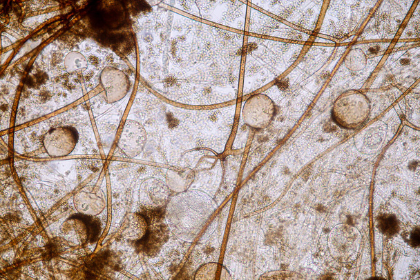 Caratteristiche di Rhizopus è un genere di funghi saprofiti comuni su scivolo al microscopio per l'educazione. - Foto, immagini