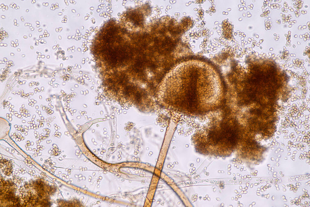Charakteristika Rhizopus je rod běžných saprofytických hub na Slide pod mikroskopem pro vzdělávání. - Fotografie, Obrázek