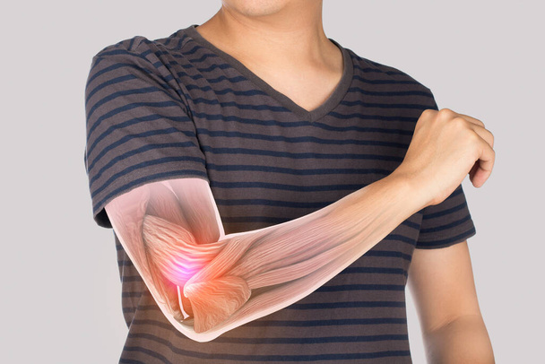 Mann spürt Schmerzen Ellenbogen, Röntgen-Ellenbogenmuskelverletzung - Foto, Bild