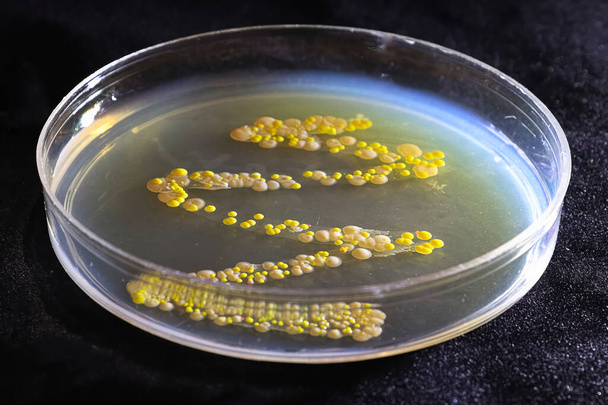 一般的な酵母と細菌コロニーを持つペトリ皿 - 写真・画像