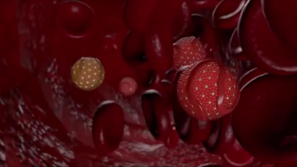 L'occlusion vasculaire se produit en raison du cholestérol dans le corps - Séquence, vidéo