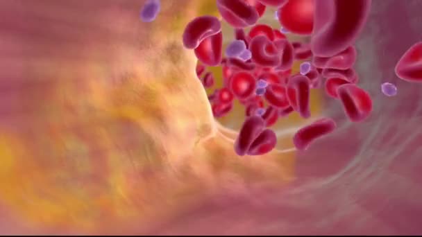 Гемофилия, свертываемость и как сгустки крови - Кадры, видео